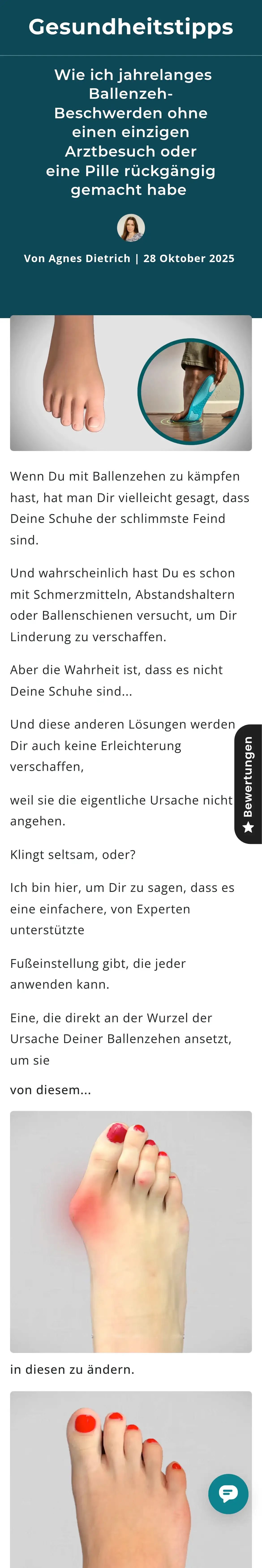 Norelie Deutschland: Wie ich jahrelanges Ballenzeh-Beschwerden ohne einen einzigen Arztbesuch oder eine Pille rückgängig gemacht habe