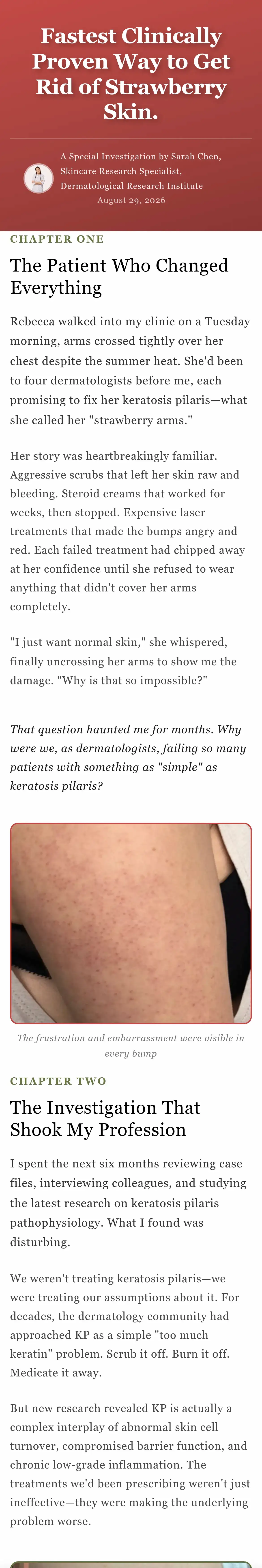 Try Strawberry: Fastest Clinically Proven Way to Get Rid of Strawberry Skin.